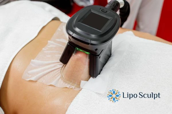 Does Fat Freezing at Home Work? DIY Devices vs Professional Cryolipolysis 1 How is professional cryolipolysis different Bridport?