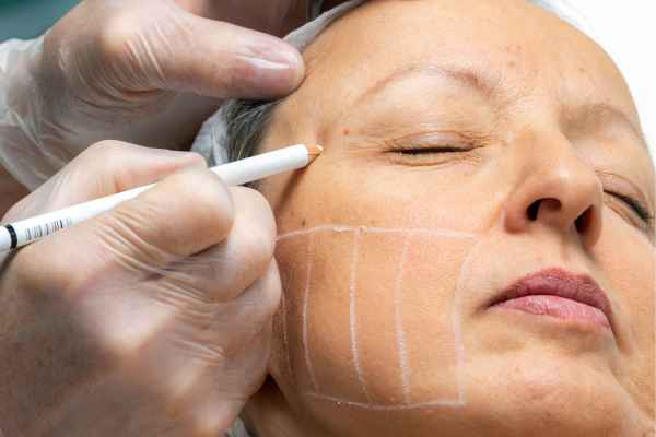 CryoPen: 5 Skin Concerns It May Be Used to Treat 4 What should you ask before having CryoPen treatment Bridport?
